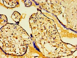 Polyclonal Rabbit anti-Human HAUS6 / FAM29A Antibody (aa676-955, IHC)