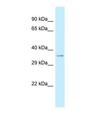 Polyclonal Rabbit anti-Human CRISPLD1 Antibody (aa237-286, WB)