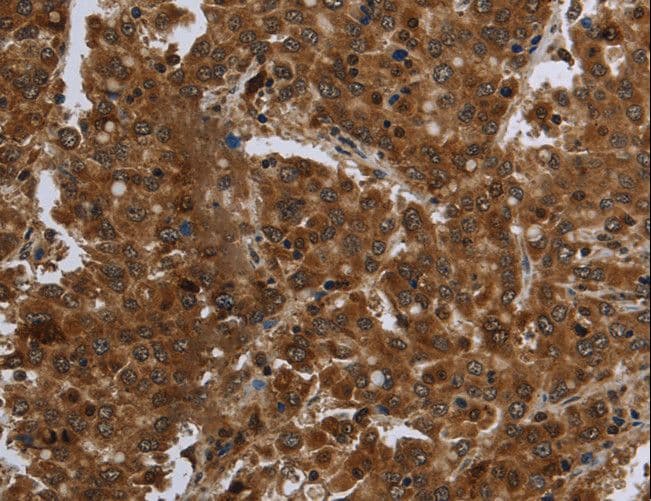 FASTKD1 Antibody