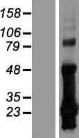 CRIP2 Protein (Over-Expression Lysate Myc-DDK (Flag))