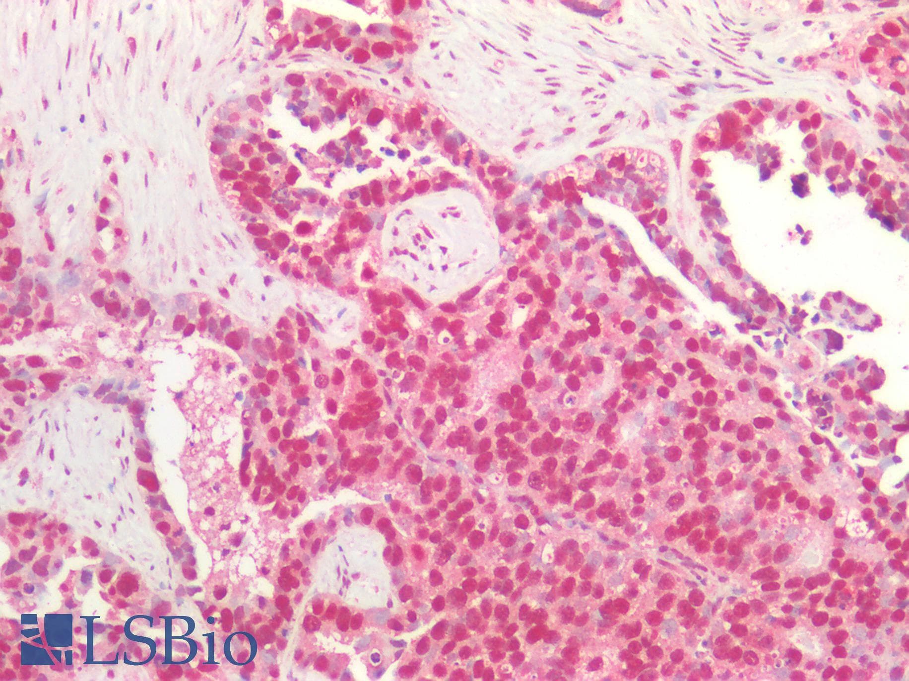 PathPlus™ Polyclonal Rabbit anti-Human MYC / c-Myc Antibody (IHC)