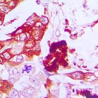 Polyclonal Rabbit anti-Human AQP3 / Aquaporin 3 Antibody (Internal, IHC, WB)