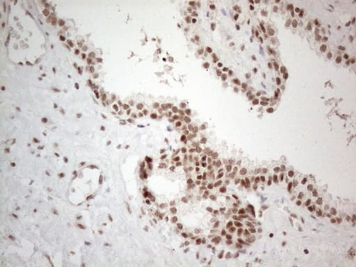 NR2C2 / TAK1 Antibody (aa1-241, clone OTI4B1)