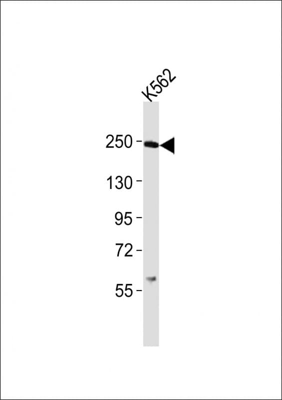 SMARCA4 / BRG1 Antibody (aa1352-1386)