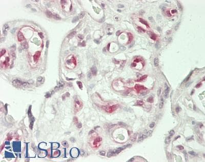 IHC-plus™ ANAPC7 / APC7 Antibody (aa515-565)