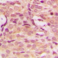 Polyclonal Rabbit anti-Human AKT1 Antibody (C-Terminus, IHC, WB)