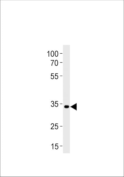 Polyclonal Rabbit anti-Zebrafish pax2a Antibody (aa258-284, WB)
