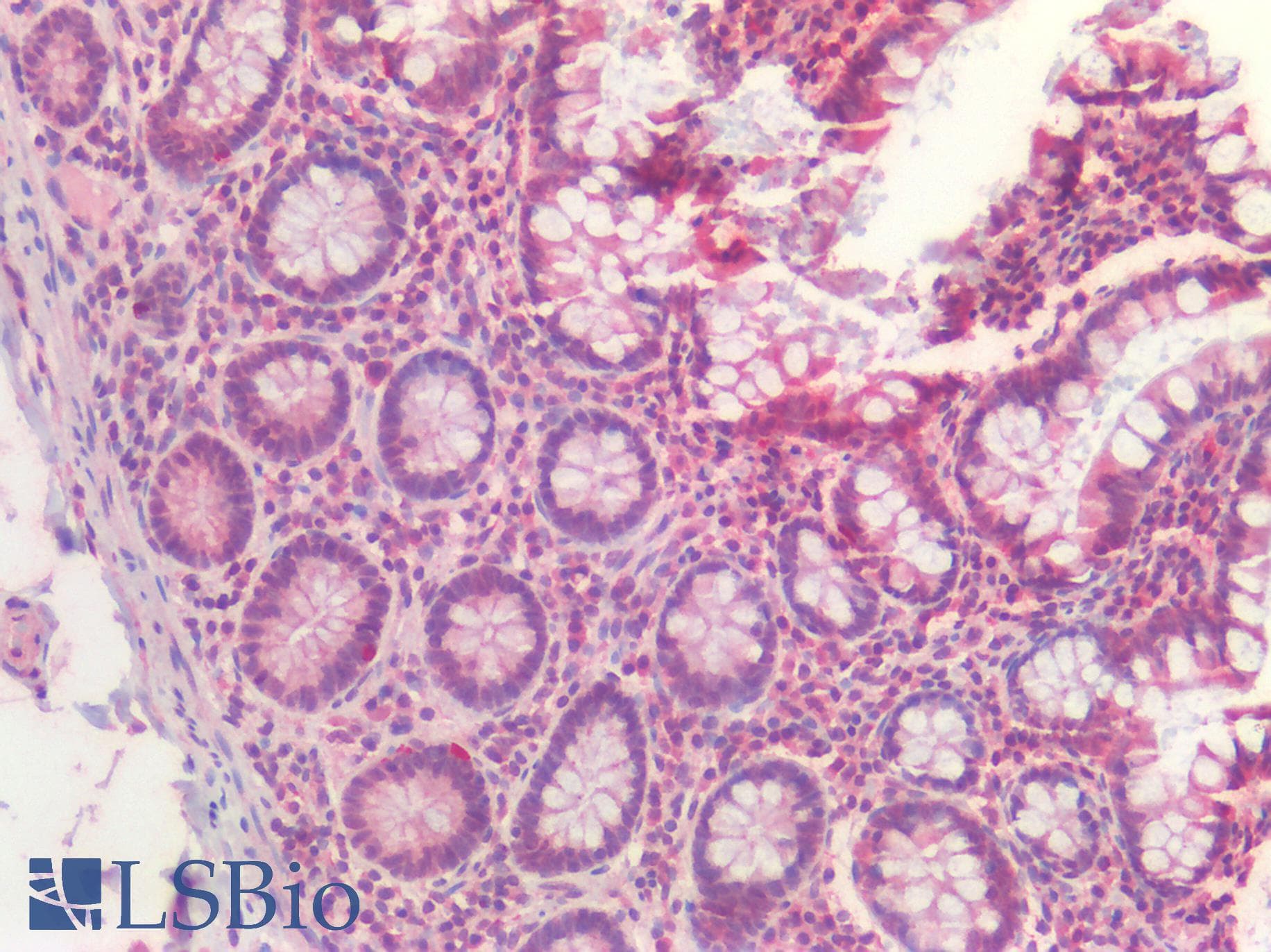 IHC-plus™ Polyclonal Rabbit anti-Human CASP3 / Caspase 3 Antibody (IHC)