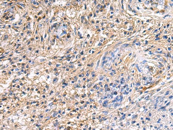 SAV1 / WW45 Antibody