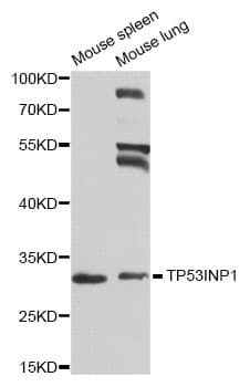 SIP / TP53INP1 Antibody