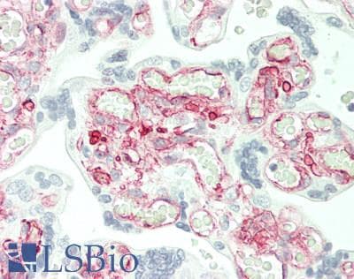 IHC-plus™ EGFR Antibody (Internal)