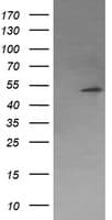 Monoclonal Mouse anti-Human PPM1B Antibody (clone OTI3C9, IF, WB)