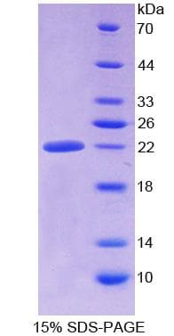 Human ALDH1A3 Protein (Recombinant His)
