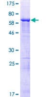 Human KIAA1456 / C8orf79 Protein (Recombinant GST)