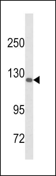 DSC1 / Desmocollin 1 Antibody (aa659-687)