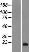 PTP4A3 Protein (Over-Expression Lysate Myc-DDK (Flag))