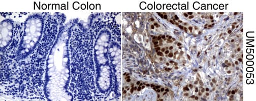 TP53 / p53 Antibody (clone UMAB62, Carrier-free)