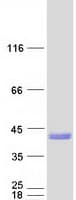 Human SNX11 Protein (Recombinant Myc-DDK (Flag))