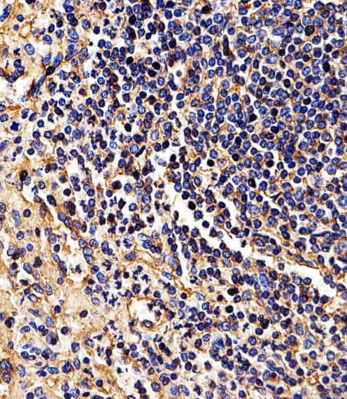 HLA-B Antibody (N-Terminus)