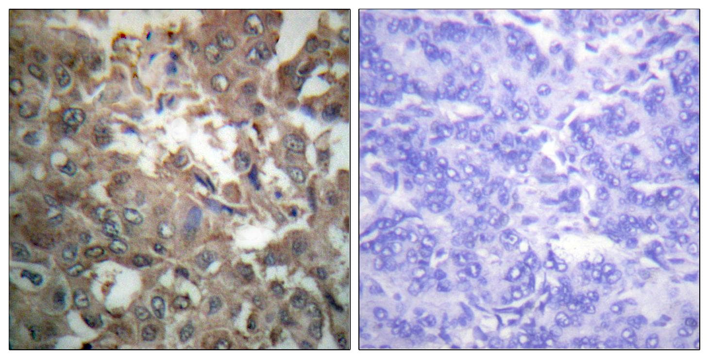 XPA Antibody