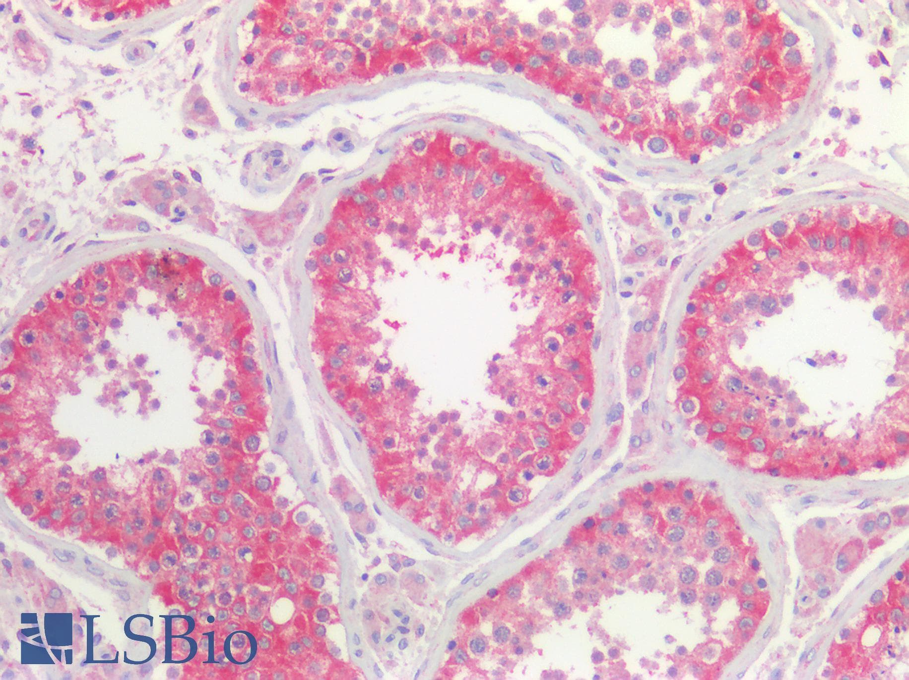 PathPlus™ Polyclonal Rabbit anti-Human 5-Alpha Reductase / SRD5A1 Antibody (IHC)