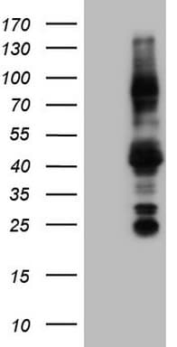 NR3C1/Glucocorticoid Receptor Antibody (aa1-265, clone OTI2E12)