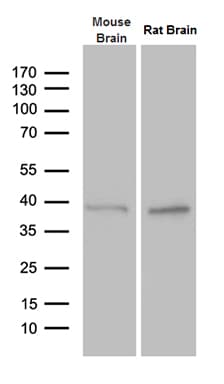 PTF1A Antibody (clone OTI1H6)