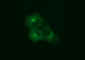 SYP / Synaptophysin Antibody (clone OTI1D4)