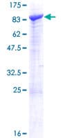 Human SCFD2 Protein (Recombinant GST)