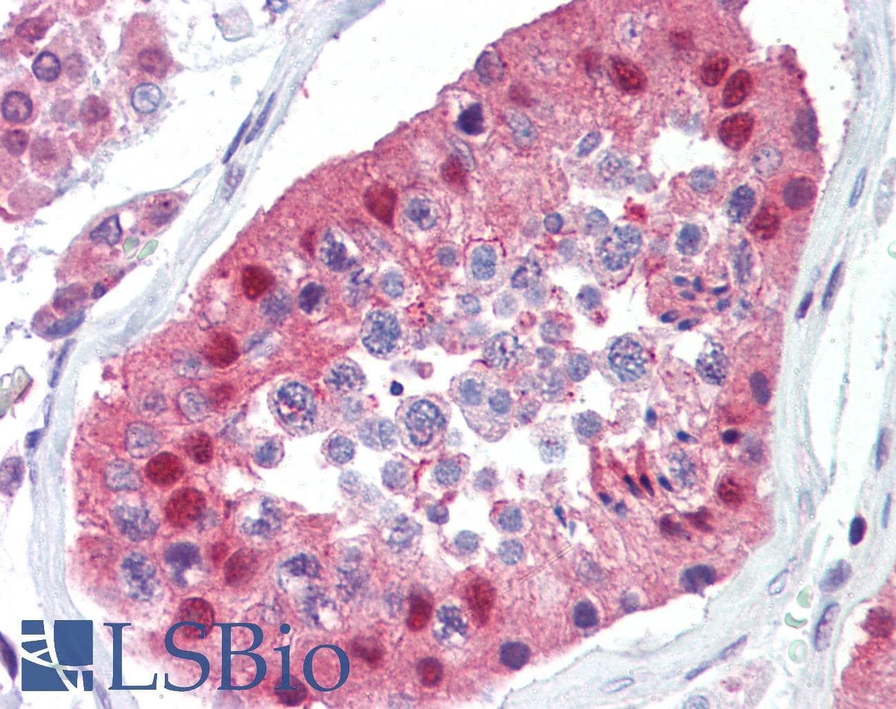 IHC-plus™ UBC / Ubiquitin C Antibody (aa36-66)