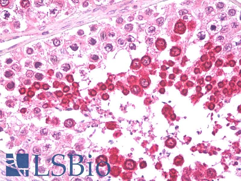 IHC-plus™ Polyclonal Goat anti-Human IFT57 / HIPPI Antibody (aa103-117, IHC, WB)