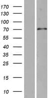 SPAG16 Protein (Over-Expression Lysate Myc-DDK (Flag))