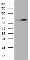 HSPD1 / HSP60 Antibody (clone OTI6F7)