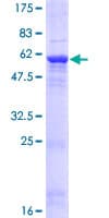 Human FN3KL / FN3KRP Protein (Recombinant GST)