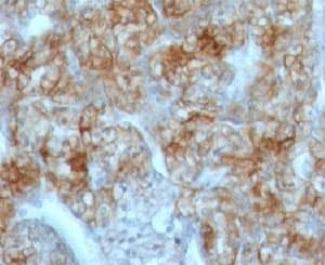 PathPlus™ CDH16 / Cadherin 16 Antibody (clone CDH16/1071)
