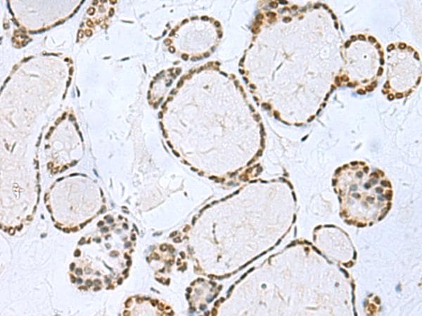 TH / Tyrosine Hydroxylase Antibody