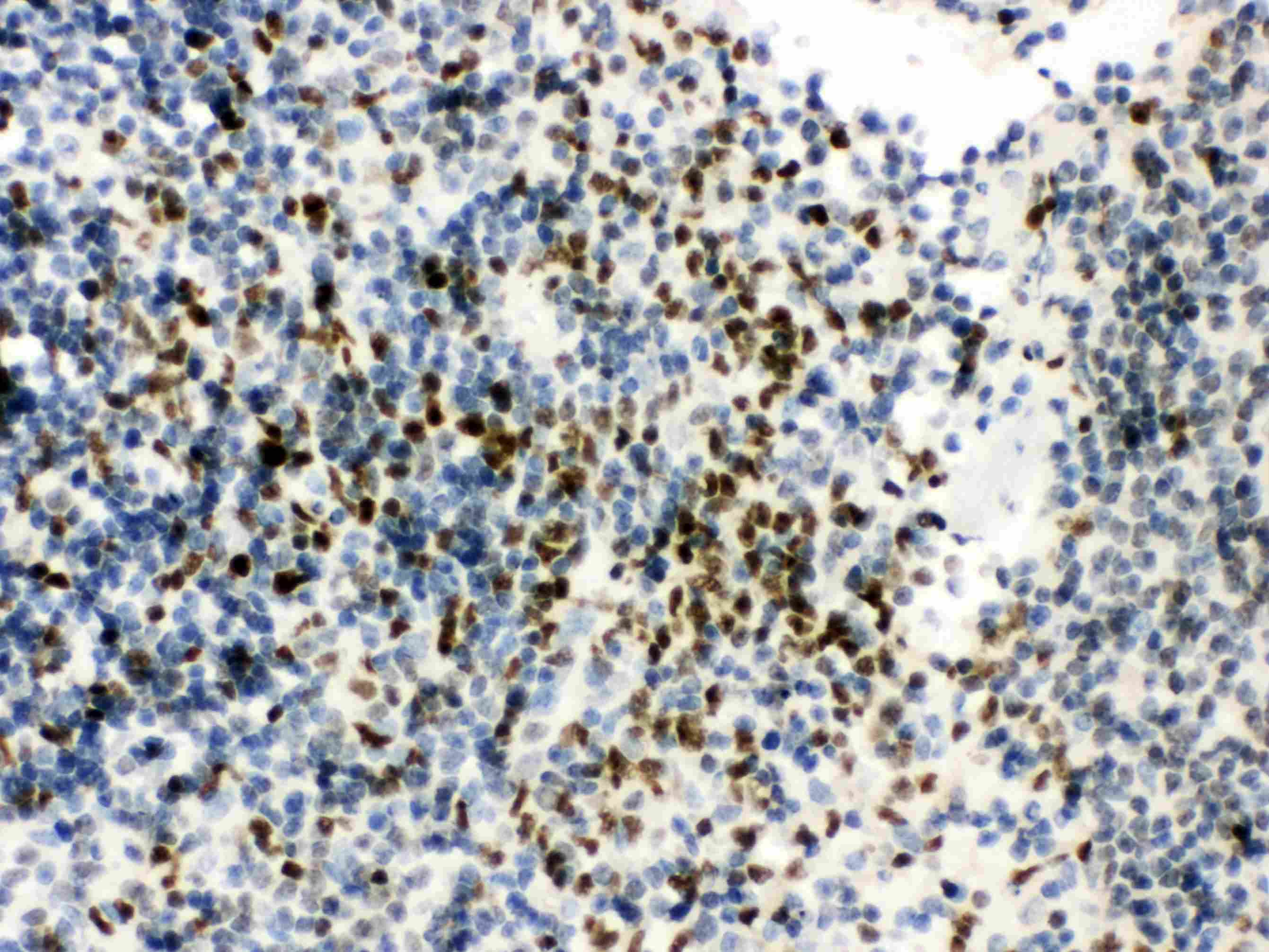 Polyclonal Rabbit anti-Human RUNX3 Antibody (IHC, WB)