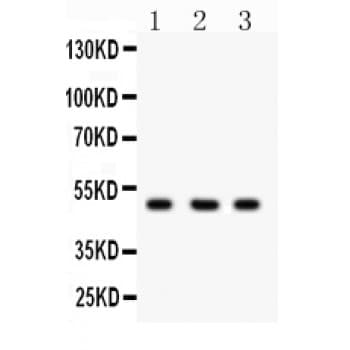 CTBP2 Antibody (aa321-445)