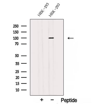 Polyclonal Rabbit anti-Human STT3A / ITM1 Antibody (WB)