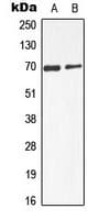 Polyclonal Rabbit anti-Human Alpha-Fetoprotein Antibody (Internal, WB)