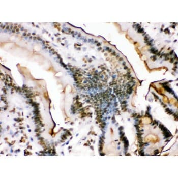 FOSB Antibody (aa264-291)