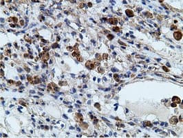 KHK / Ketohexokinase Antibody (clone OTI3D1)