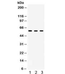 Polyclonal Rabbit anti-Human CCT4 / SRB Antibody (IHC, WB)