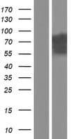 Human EFHC1 Protein (Over-Expression Lysate Myc-DDK (Flag))