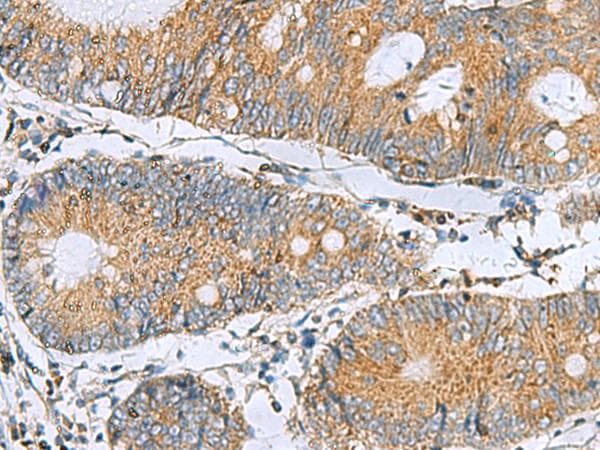 TMED10 / TMP21 Antibody