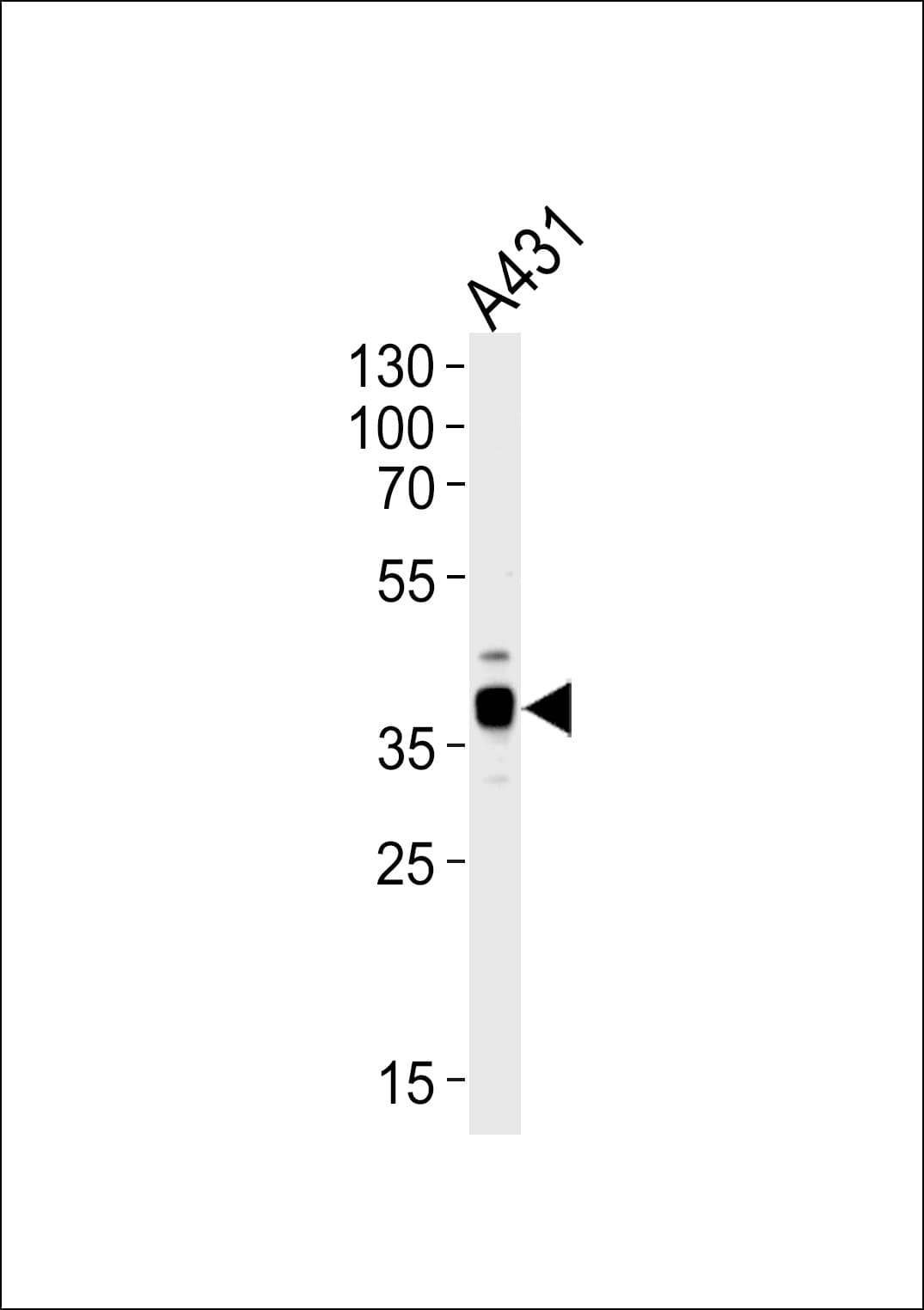 ARPC1B / p41-ARC / ARP2 Antibody (aa159-188)