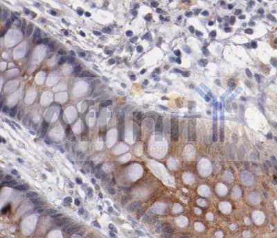 SYP / Synaptophysin Antibody
