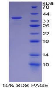 Mouse NF2 / Merlin Protein (Recombinant His-T7)