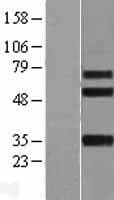 ITGBL1 Protein (Over-Expression Lysate Myc-DDK (Flag))