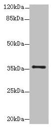 SLC35B1 / UGTREL1 Antibody